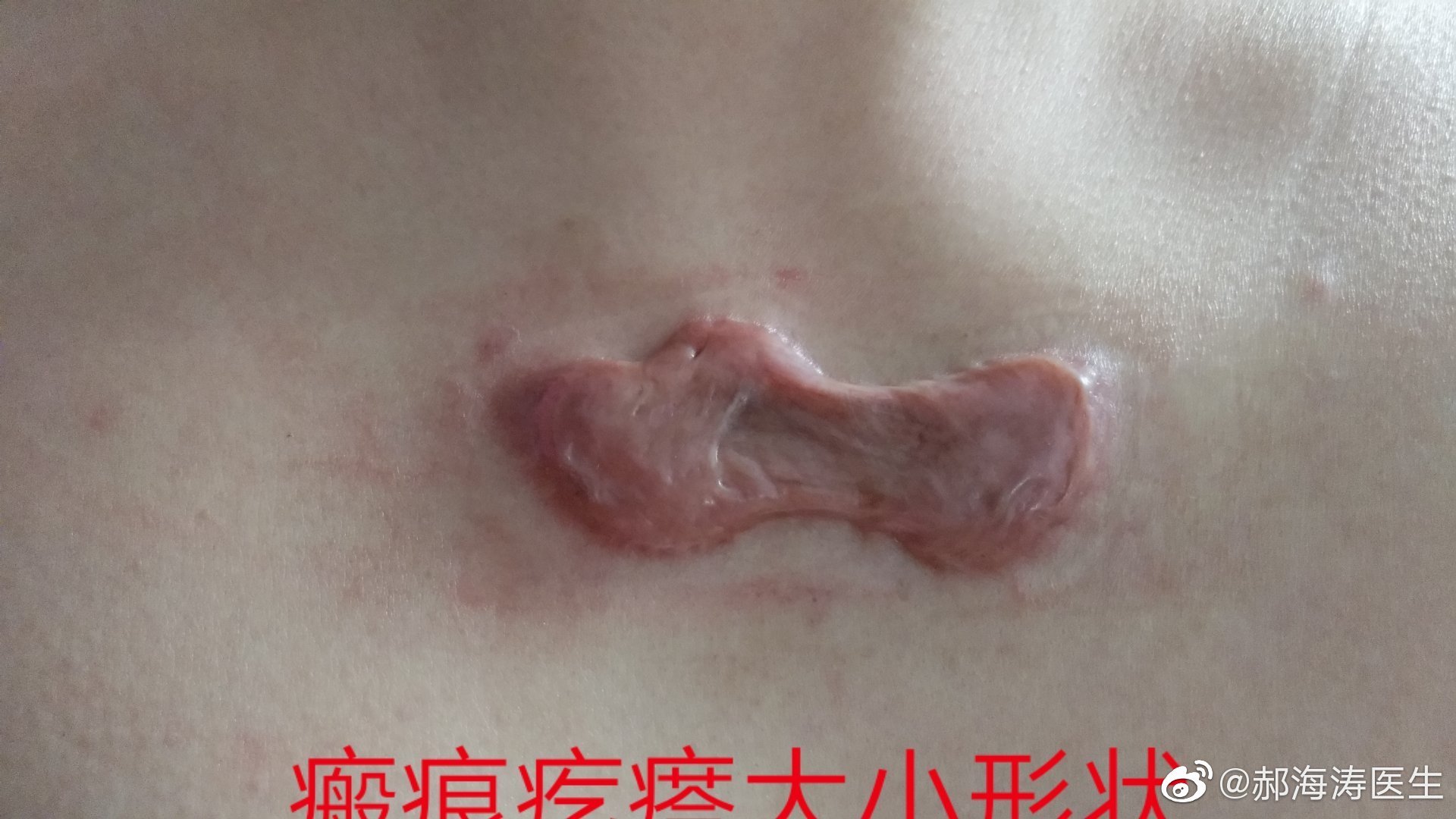 暂无