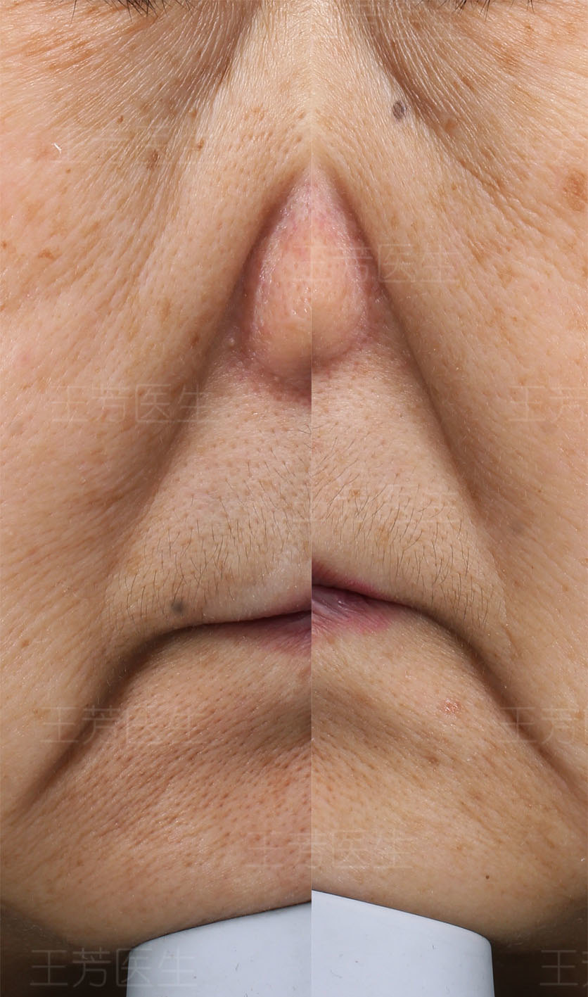 衰老的"三八线" - 好大夫在线