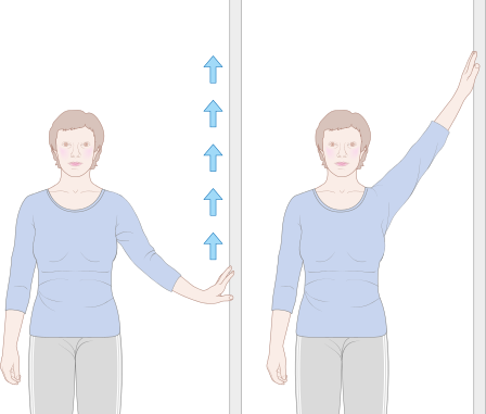 448px-Diagram_showing_how_to_walk_your_arm_up_the_wall_sideways_after_breast_reconstruction_surgery_CRUK_156.svg.png