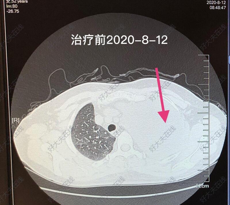 圖文圖片