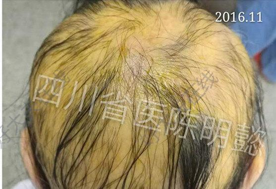 圖文圖片