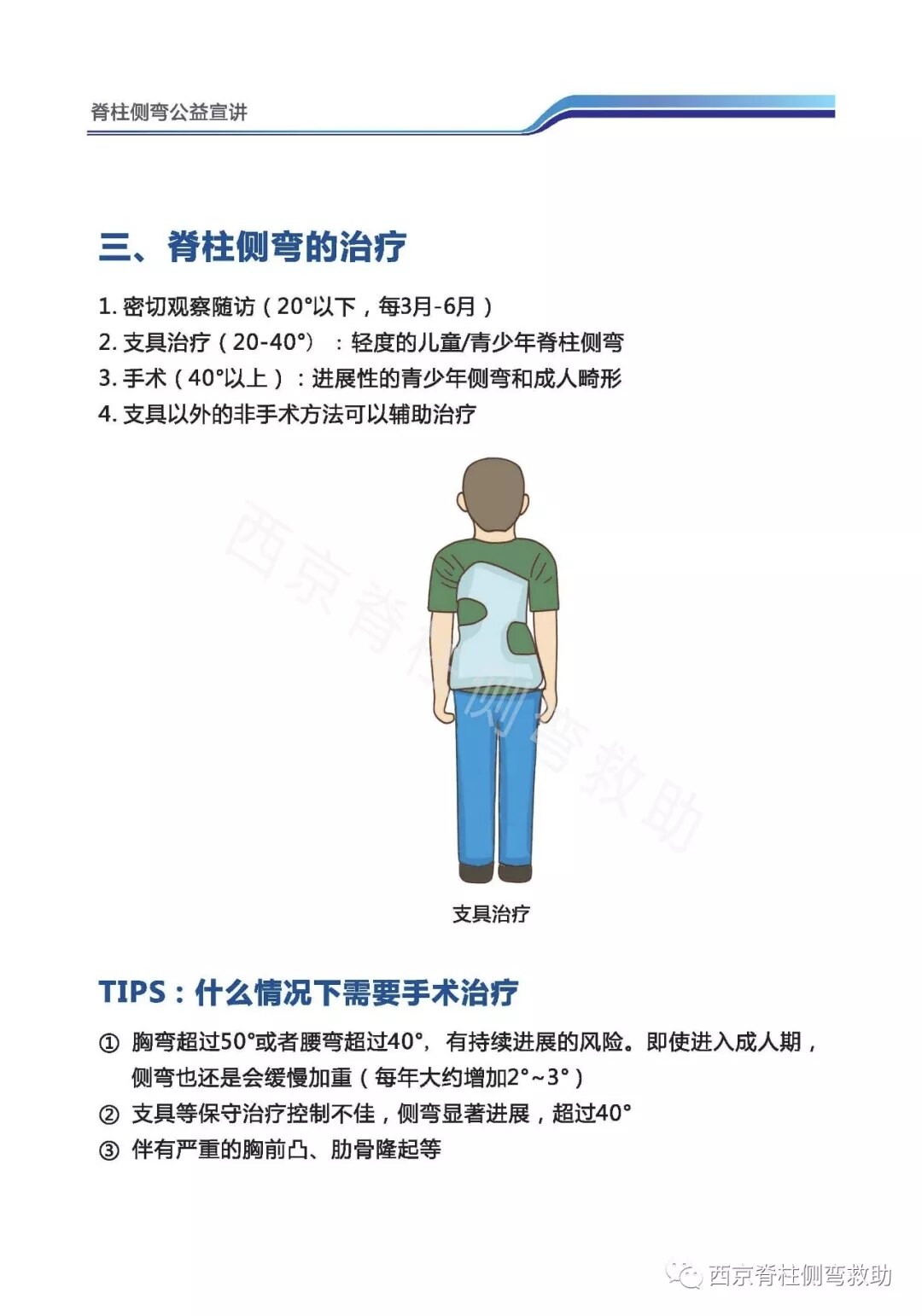 侧弯科普围观脊柱侧弯知识您都了解吗