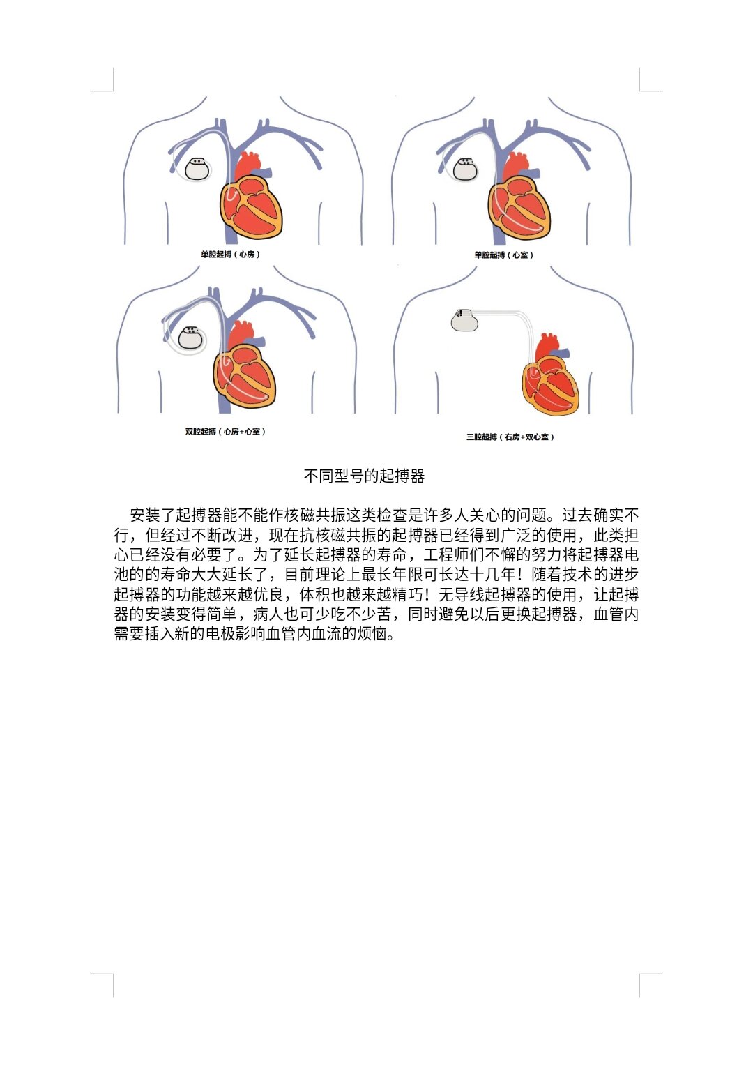 心臟起搏器保證心跳正常的機器