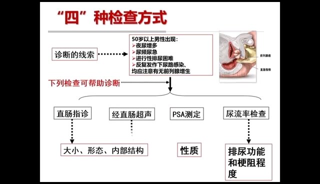 默认图片