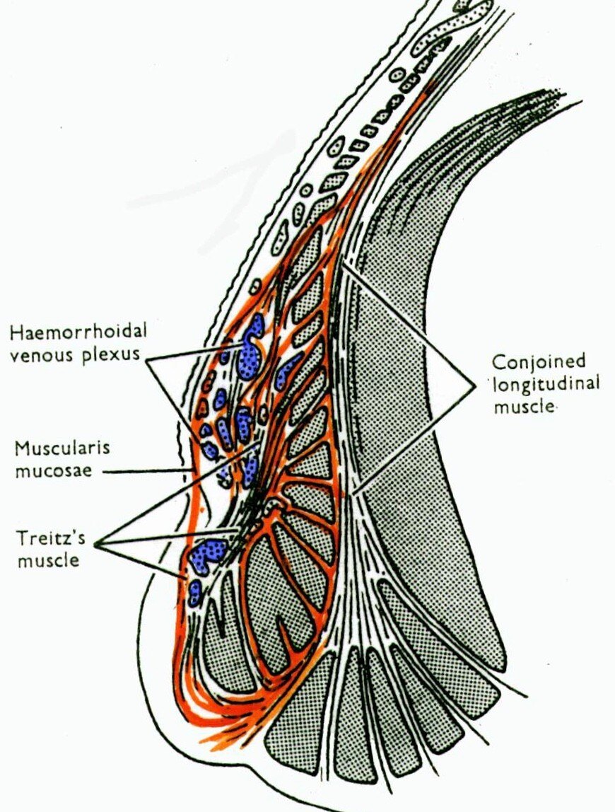 痔疮 - 好大夫在线
