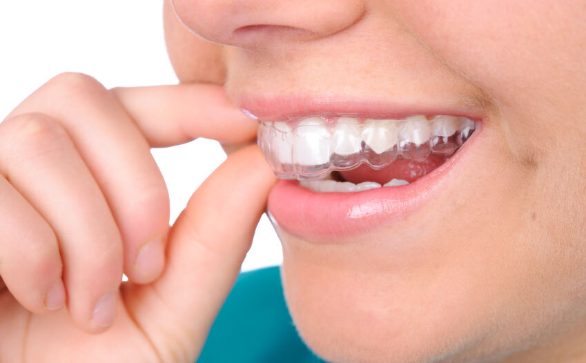 牙齿矫正结束后为什么必须要戴保持器?