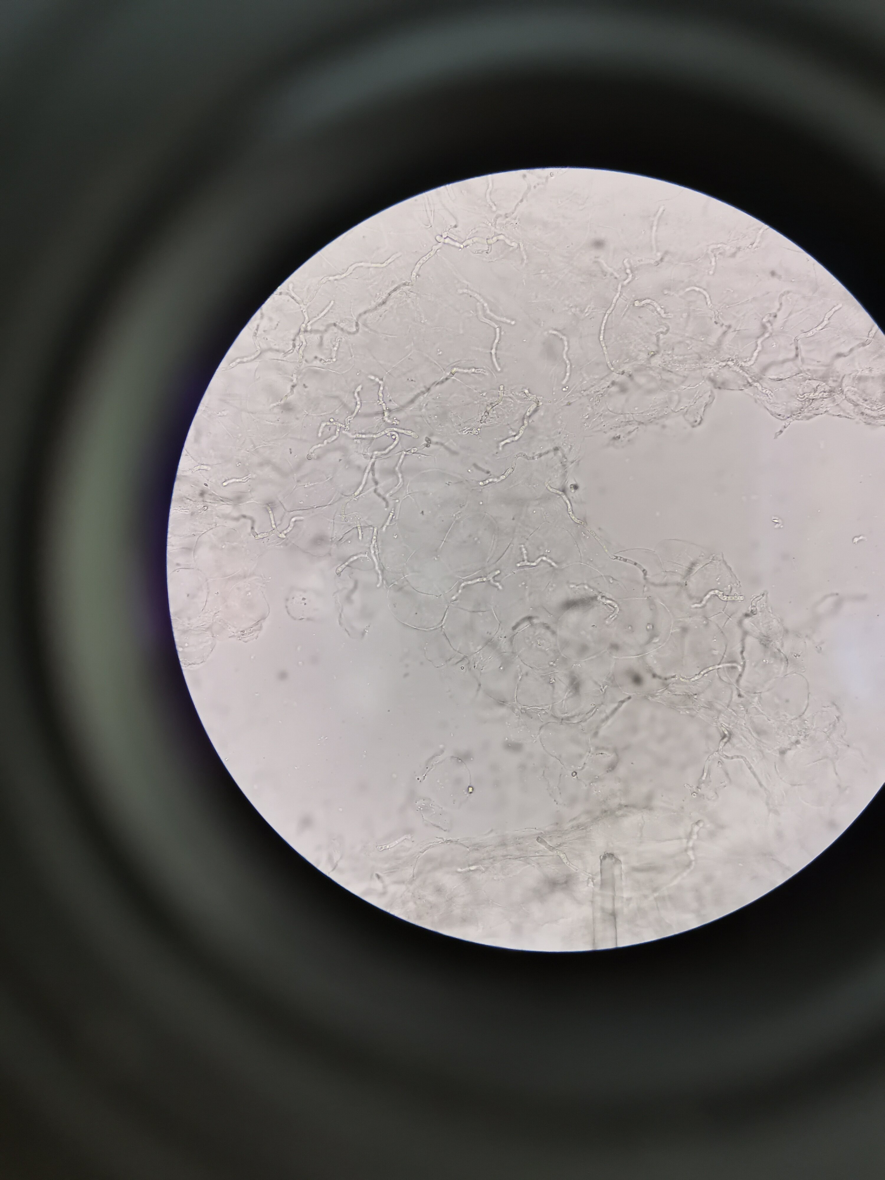 皮肤真菌显微镜下图片图片