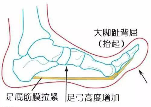 脚后跟图解图片