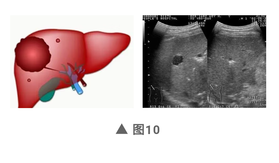 Screenshot_20210408_203215_com.tencent.mm.png