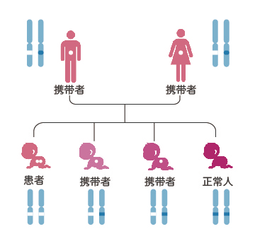 什么是基因突变引起的遗传病 0IYBAGZ03huAVKYkAADGvbXD76E128.png?_ms_=d965