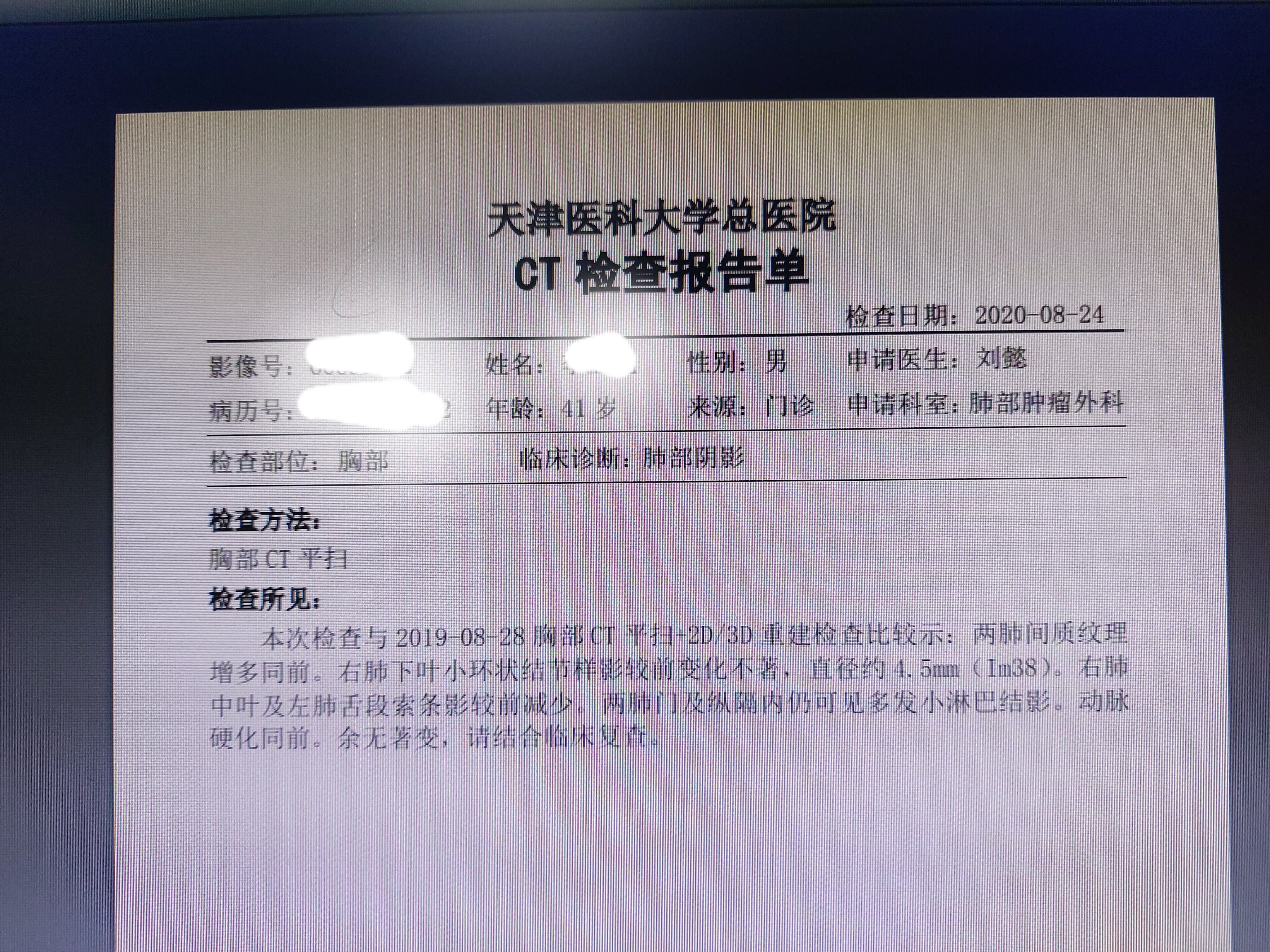 刘懿博士说肺癌一三六一45mm肺结节位于肺叶中心我建议继续观察