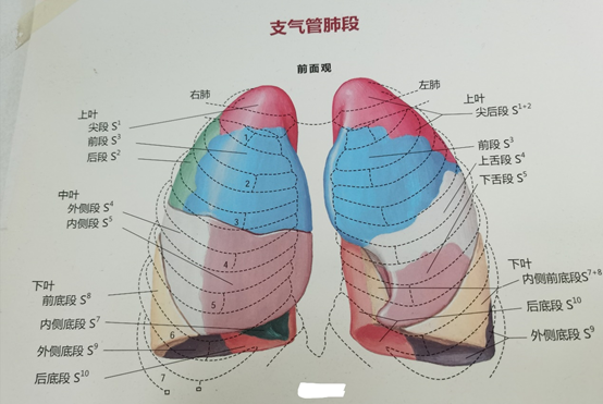 下图是肺段的解剖彩图肺段切除就是切除肺叶中间的一个段