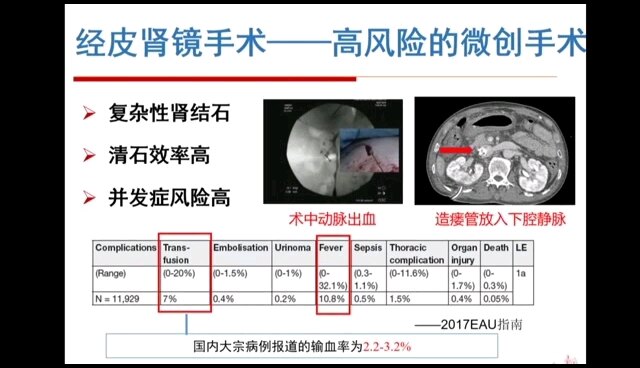 默认图片