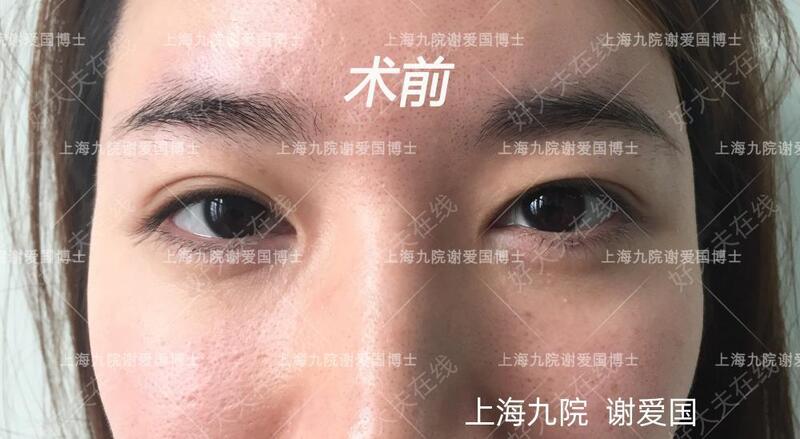 圖文圖片