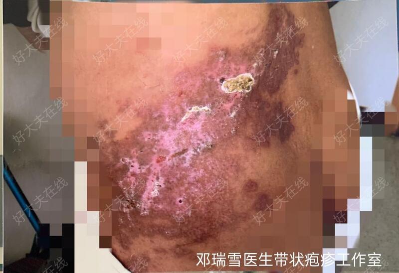 圖文圖片