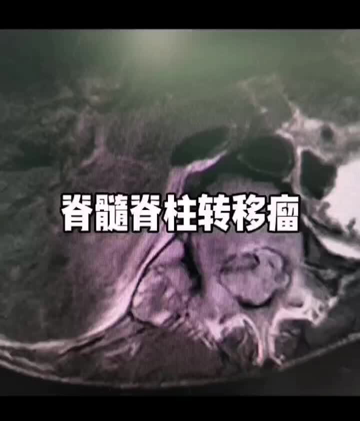 视频封面图