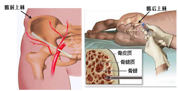骨髓检查的意义_小儿贫血_小儿贫血检查 - 好大夫在线