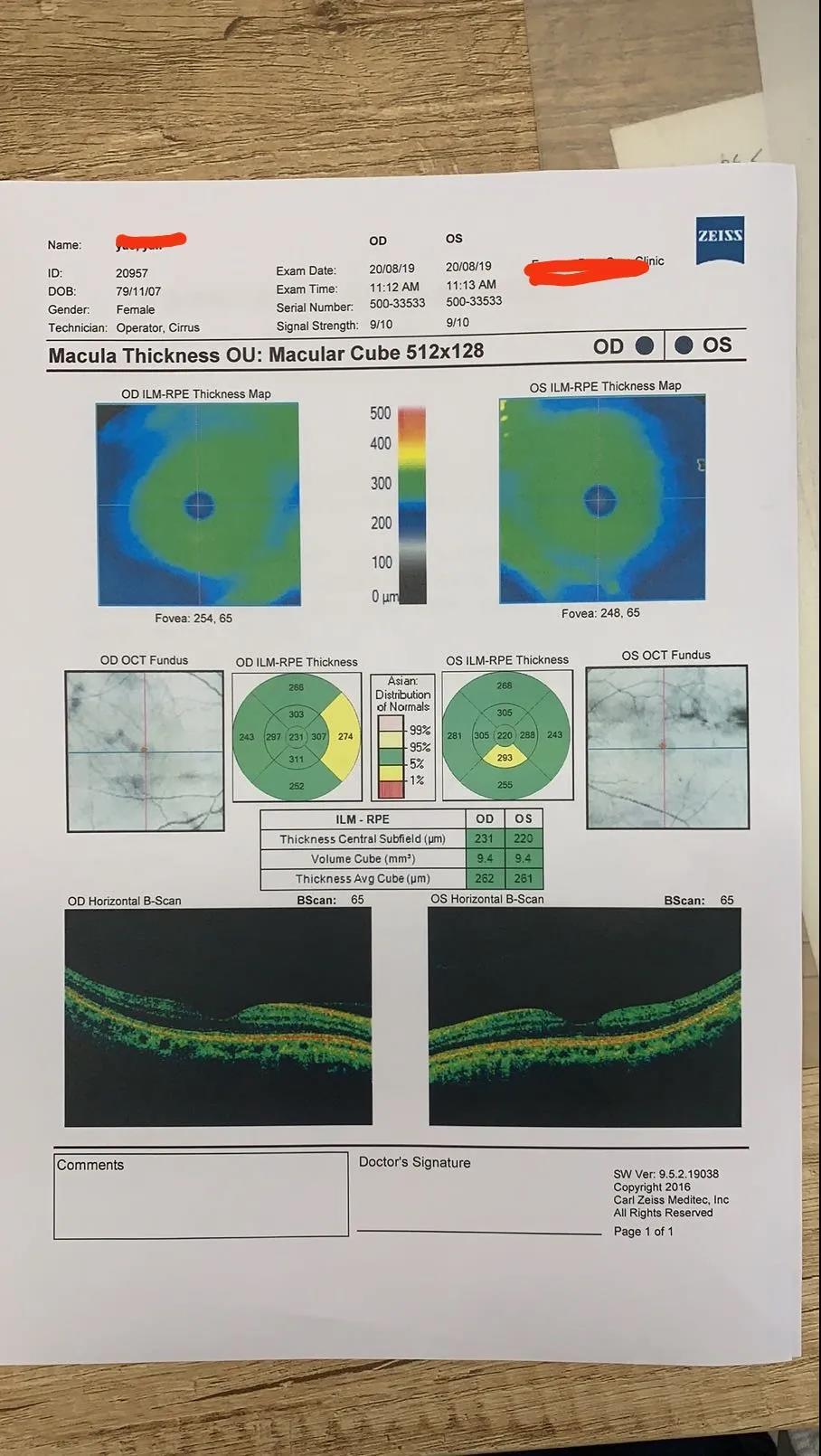 眼科检查超级攻略各种检查到底在查什么这么多检查报告如何分得清