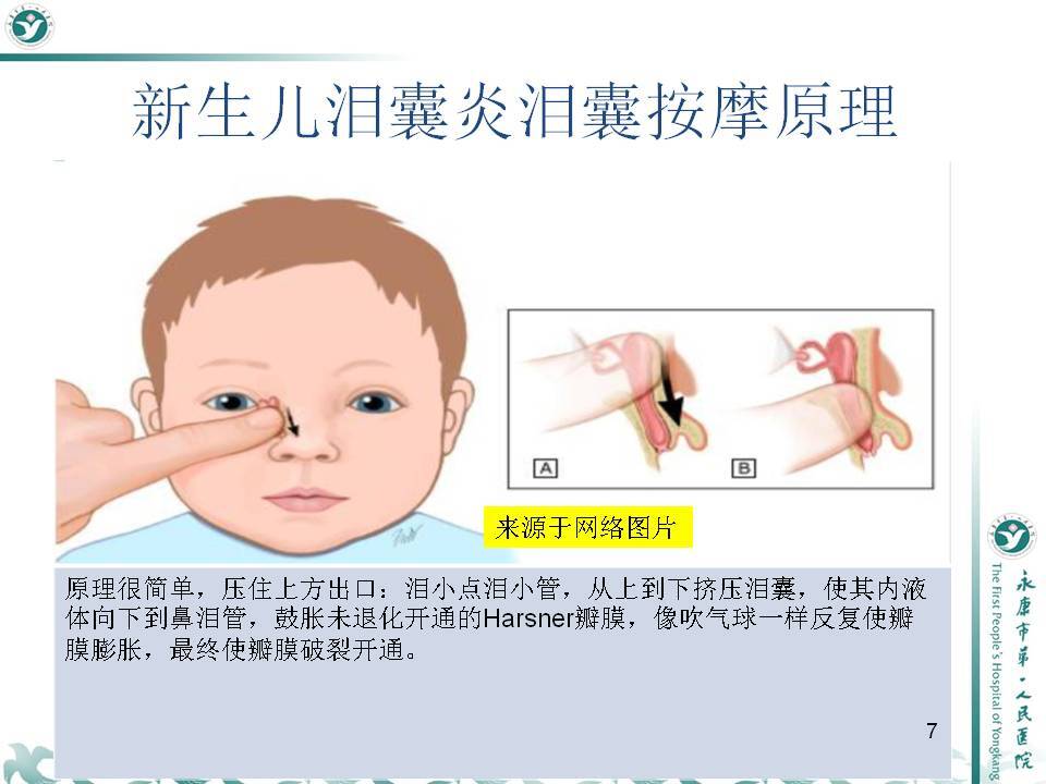 宝宝泪腺不通的按摩图图片