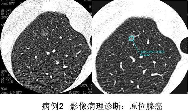 y4YBAGAT9tWAAuv-AADL4rawdBI428.jpg?_ms_0b86