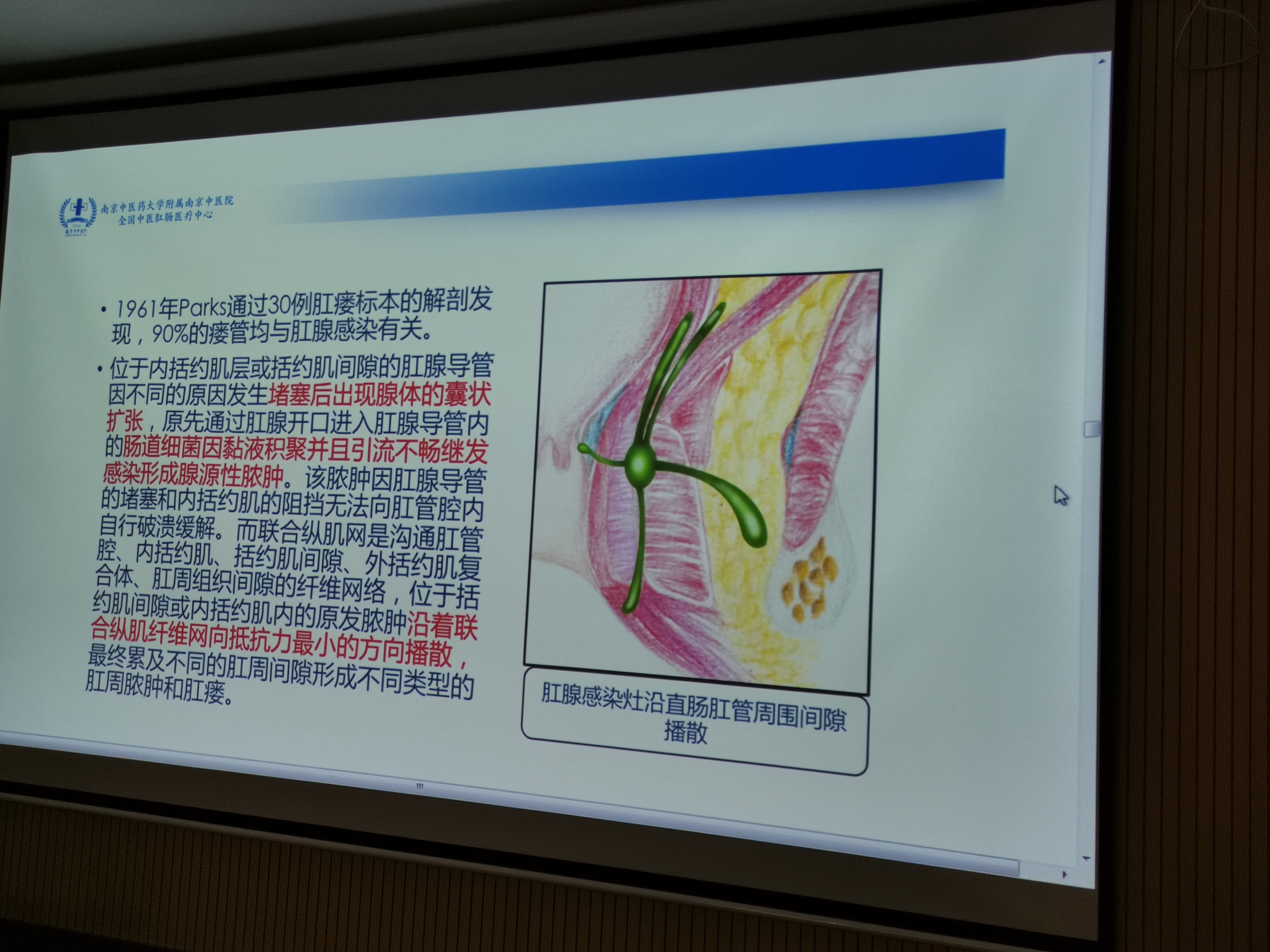 肛周脓肿窦道形成图片图片