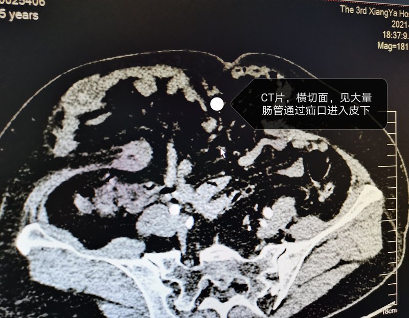 圖文圖片
