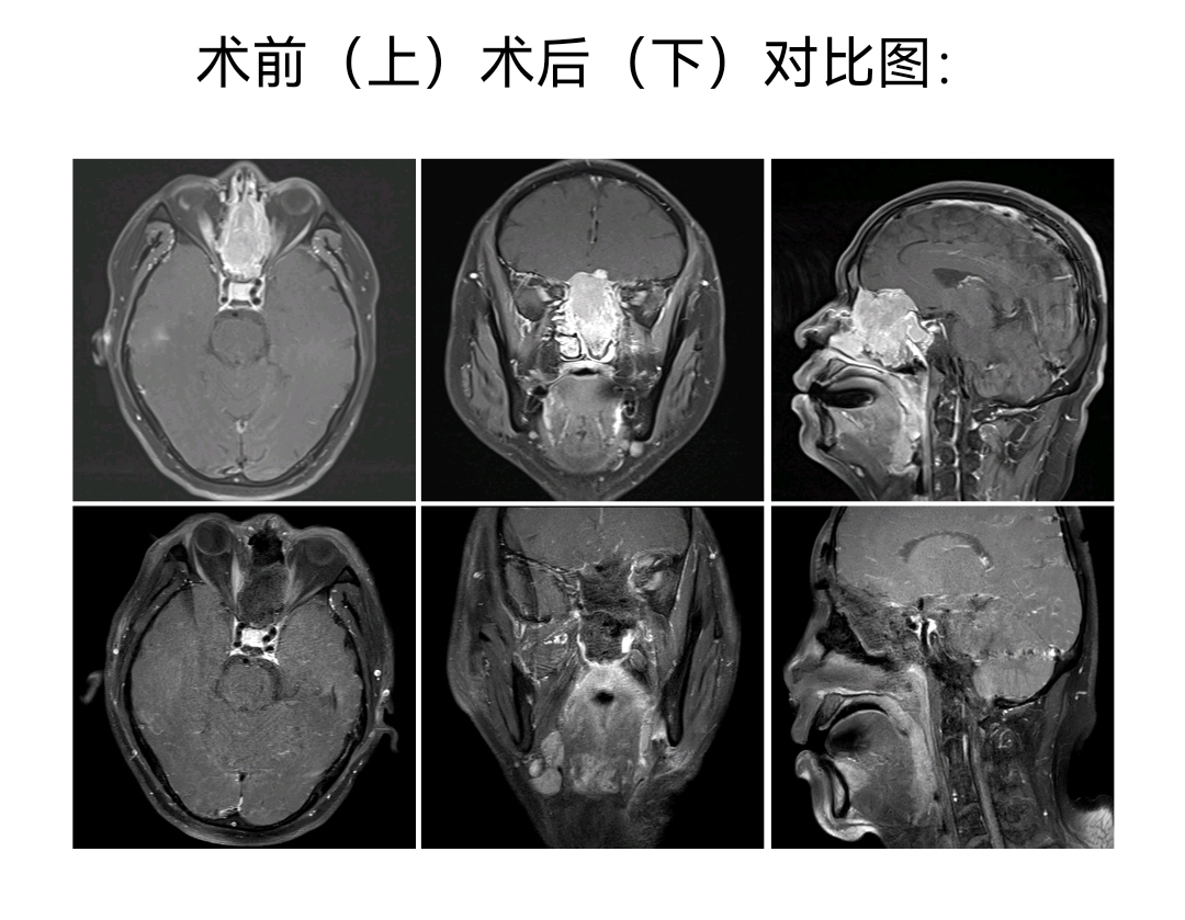 圖文圖片