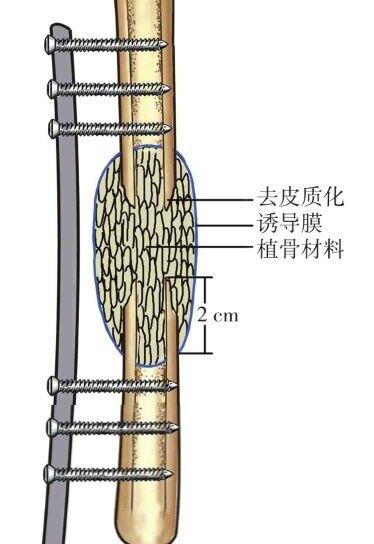图文图片