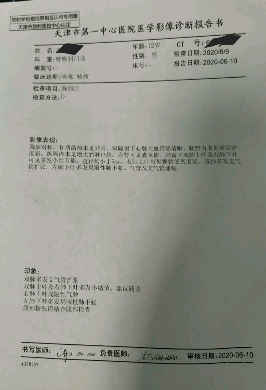 刘懿博士说肺癌一六亖八外院ct没报有多少肺结节在我院搞清了