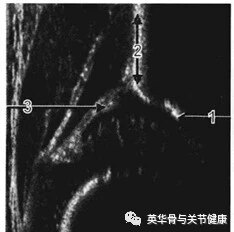 暂无