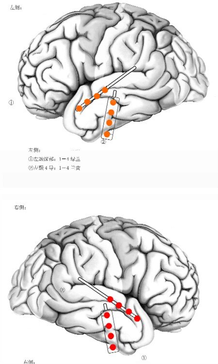 颞叶的位置图,额叶的位置图,颞叶位置_大山谷图库