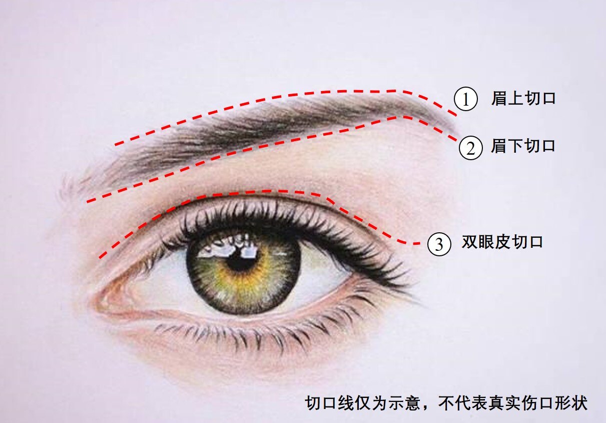 眼睛切口.jpg