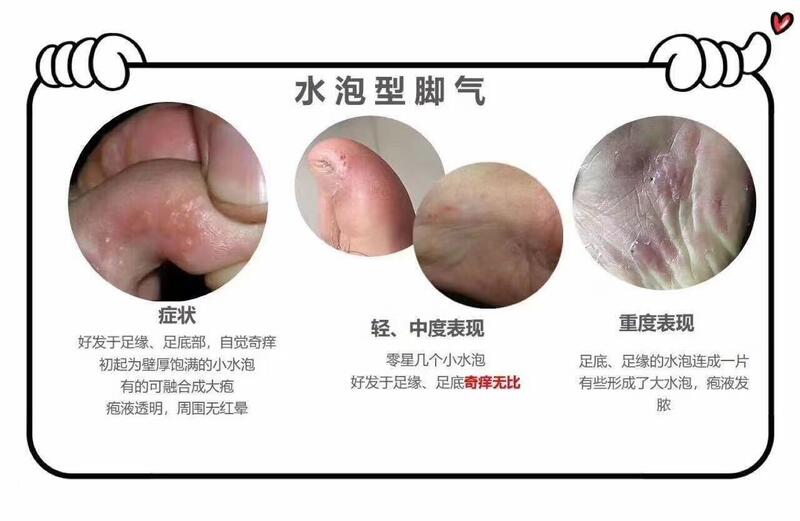 圖文圖片