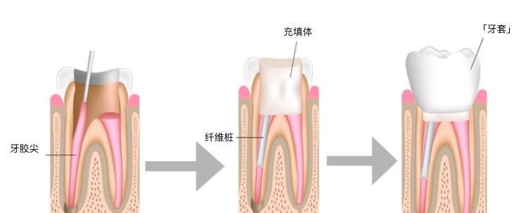 圖文圖片