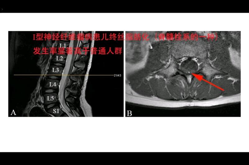 視頻封面