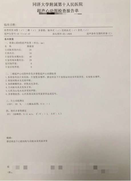 心脏超声报告怎么看