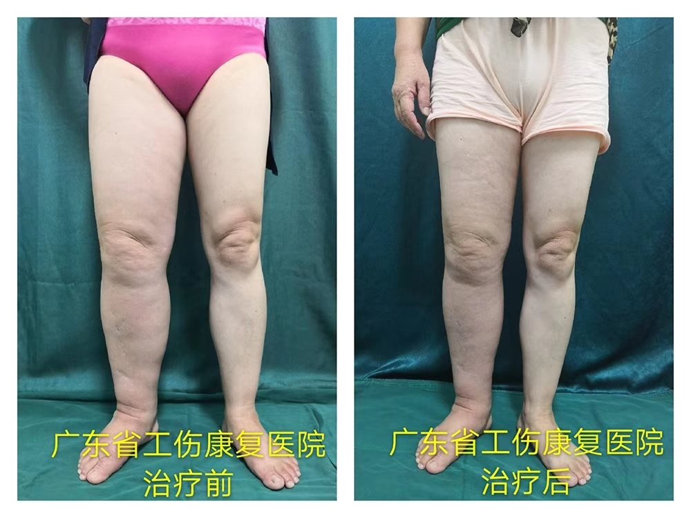 暂无