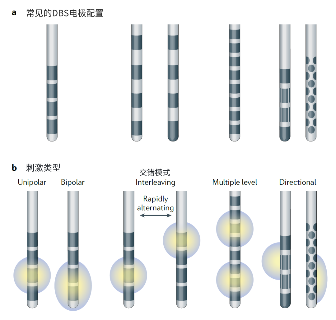 【神经调控专辑】脑深部电刺激技术：现状与未来、_脑深部电极刺激手术_脑深部电极刺激手术治疗介绍 - 好大夫在线