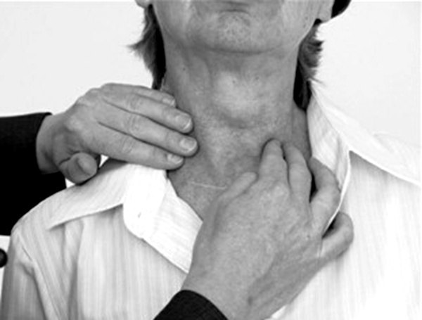 颈部一夜之间长出个大瘤子还会痛原来是甲状腺囊内出血