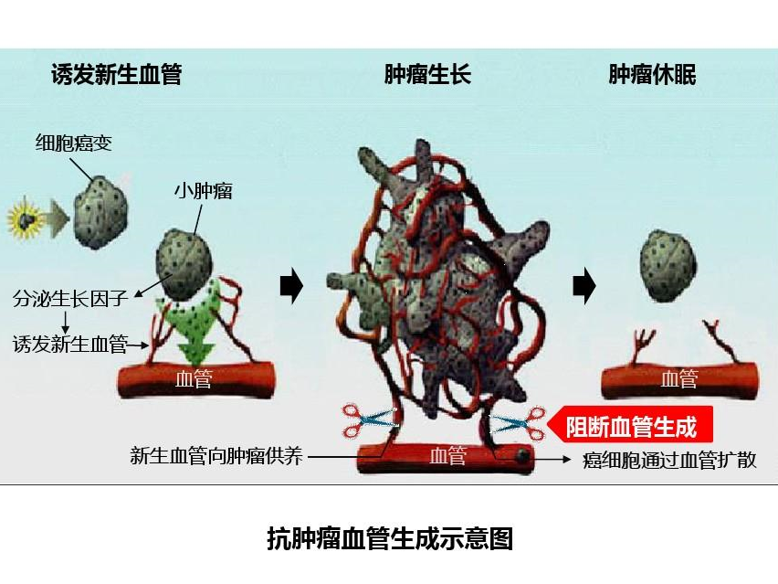 肿瘤细胞通过产生血管形成因子释放到血液,诱发肿瘤血管生成,为肿瘤