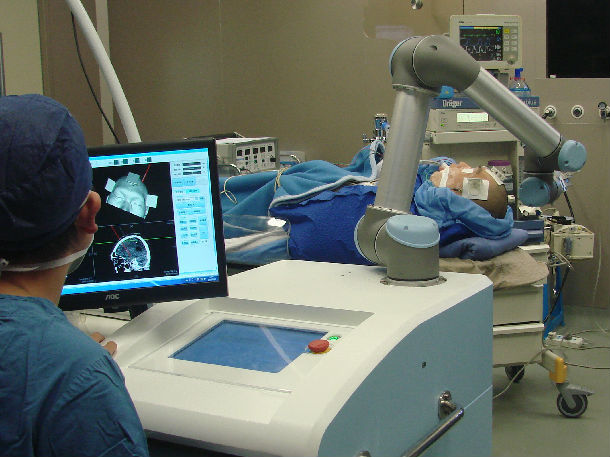 remebot机器人立体定向癫痫微创治疗,完胜传统手术! - 好大夫在线