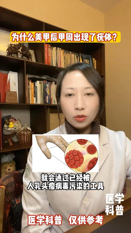 視頻封面