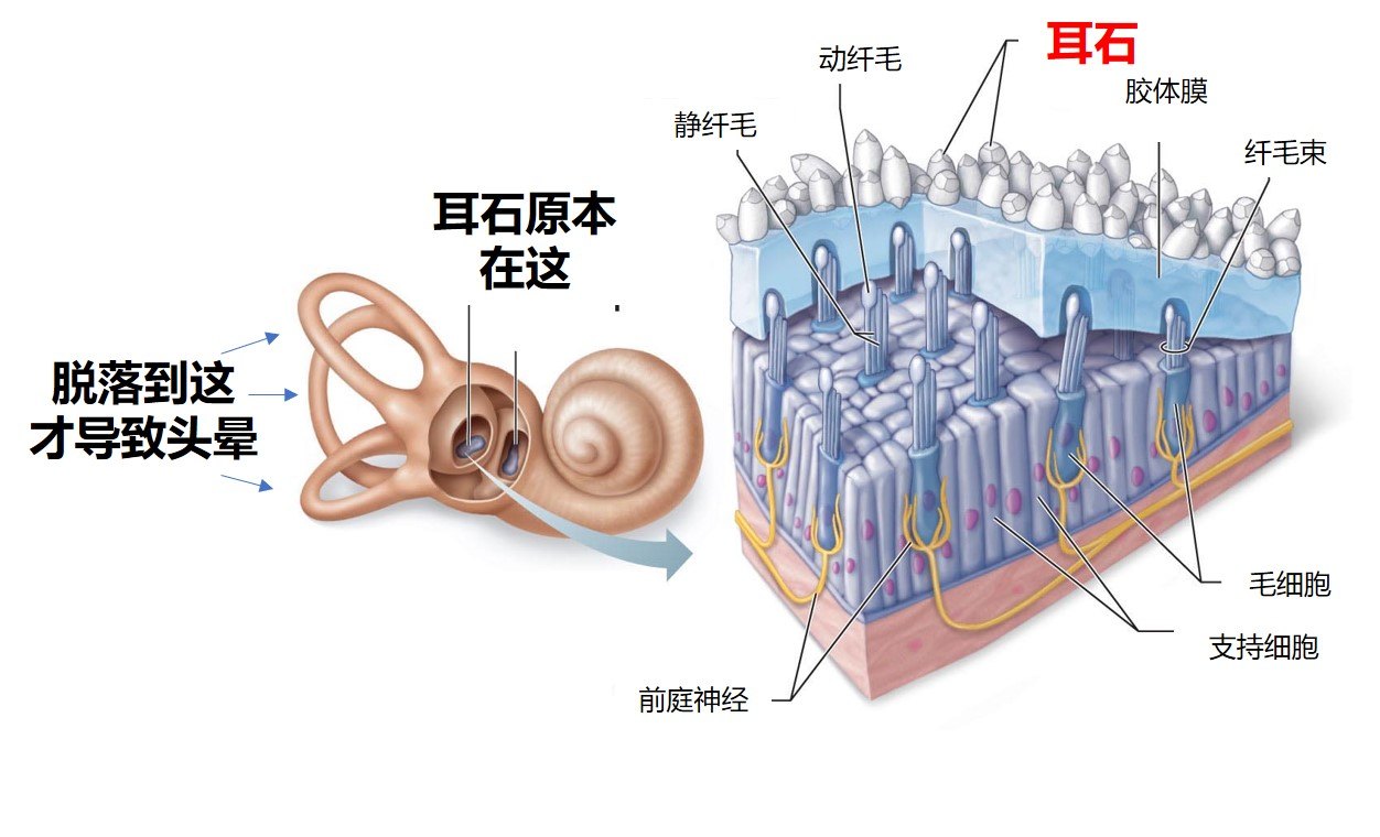 耳石解剖图片jpg