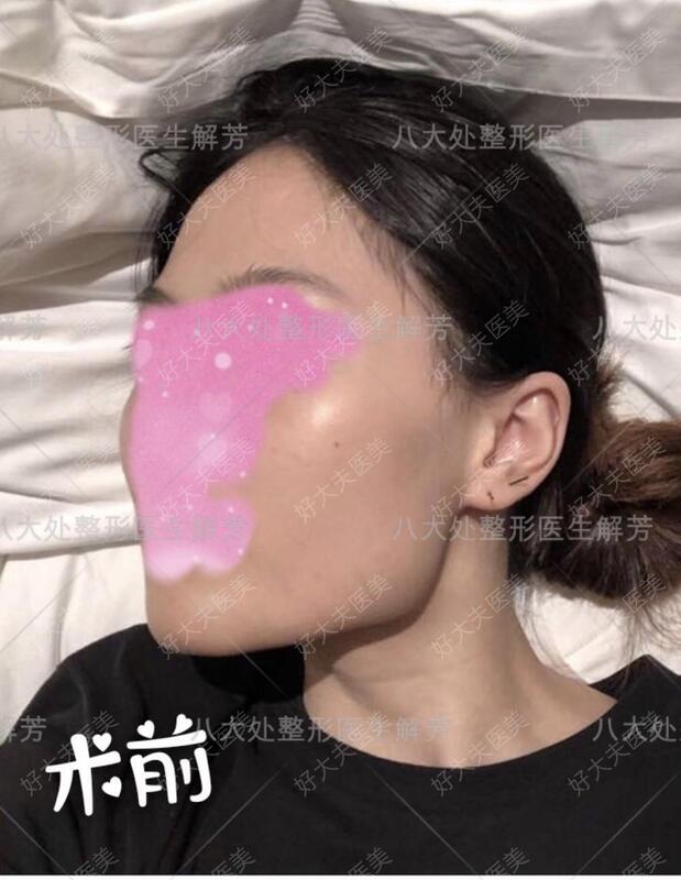 圖文圖片
