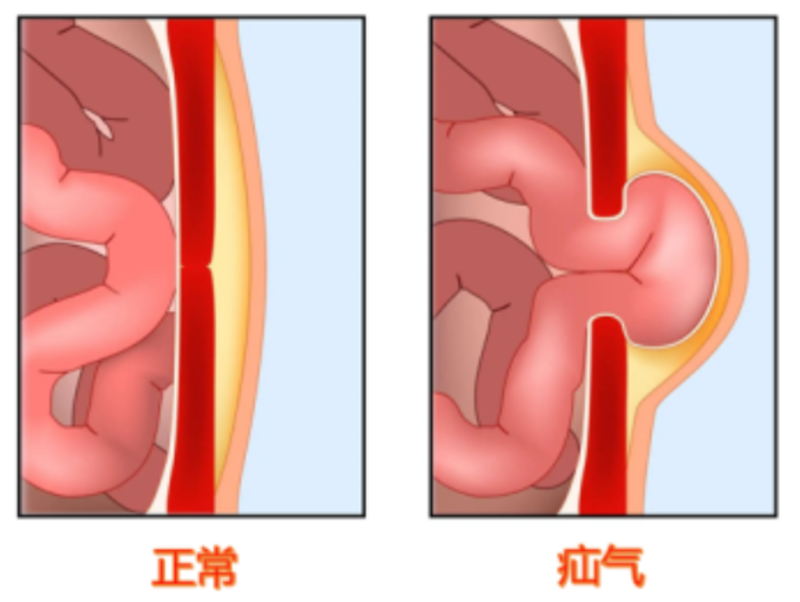 圖文圖片