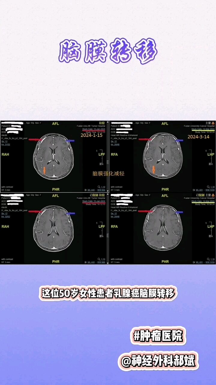 默认图片