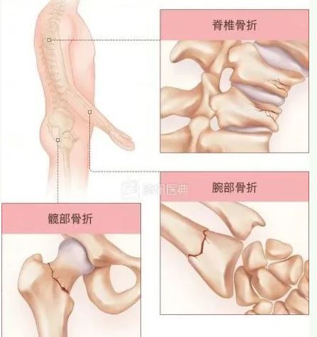 圖文圖片