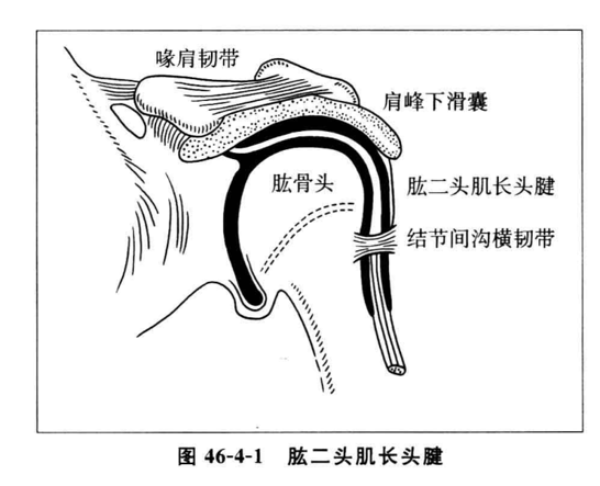 "肩周炎"逐渐被 肱二头肌长头腱鞘炎,喙突炎,冈上肌腱炎,肩峰下滑囊炎