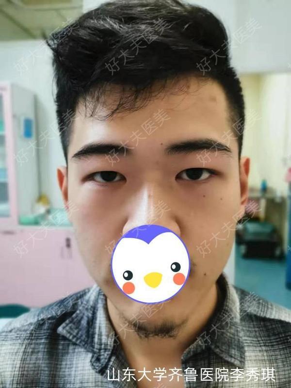 圖文圖片