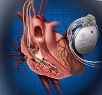 医生心脏起搏器icd反复放电怎么办